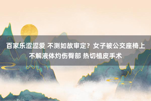 百家乐涩涩爱 不测如故审定？女子被公交座椅上不解液体灼伤臀部 热切植皮手术